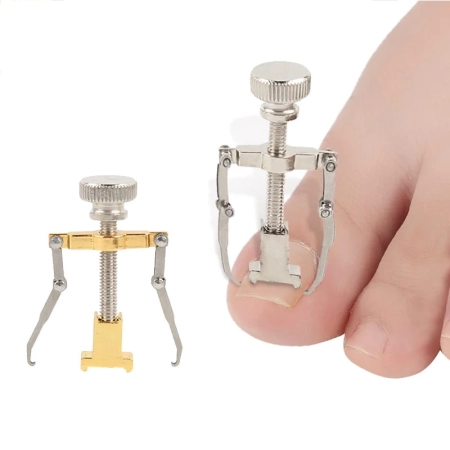 Wrastające-paznokcie