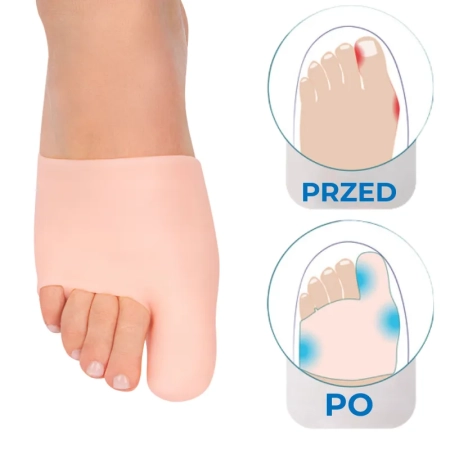 medyczny-silikon-oslona-palca.webp